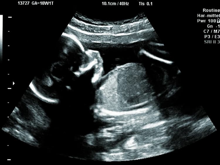 Pregnancy by Weeks