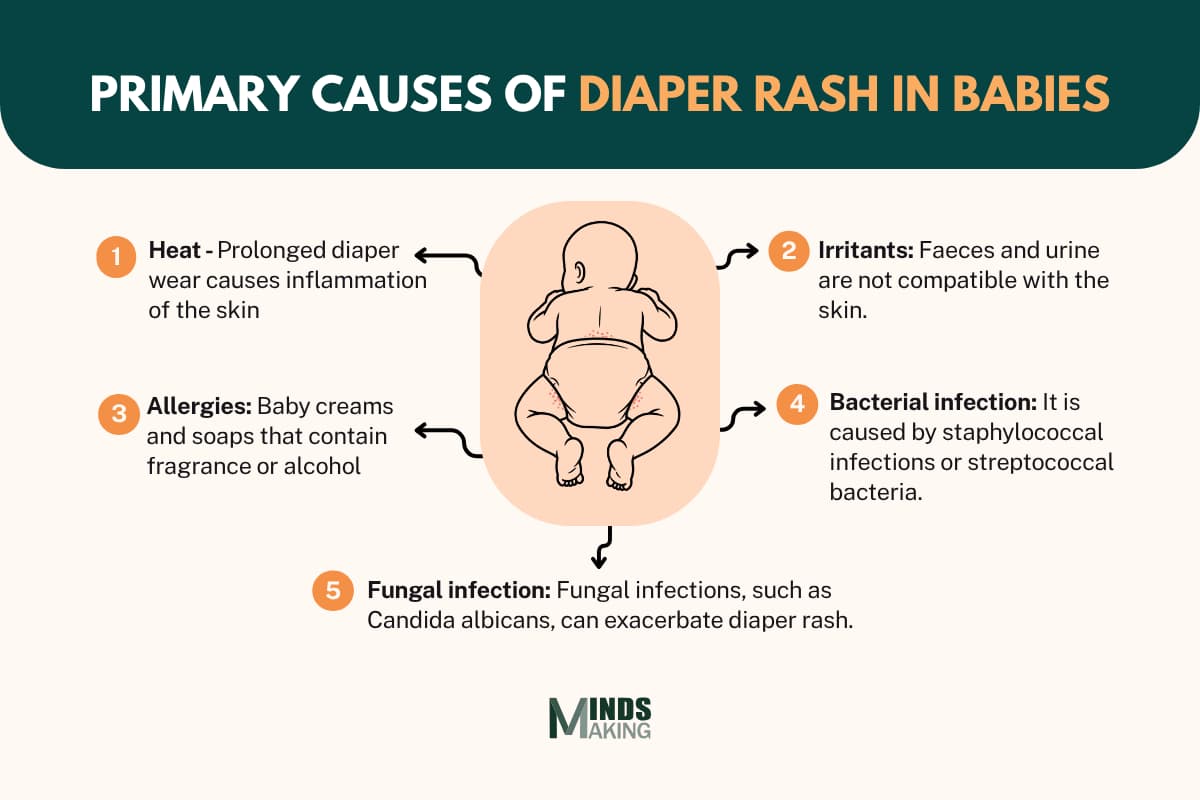 Diaper rash causes in babies: Heat from prolonged diaper wear, irritants like feces and urine, allergies to fragranced or alcohol-containing baby creams and soaps, bacterial infections (staphylococcal or streptococcal), and fungal infections (Candida albicans).