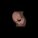 "Limited space in the womb during pregnancy