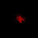 "Bloody show during pregnancy, a sign that labor may be approaching, characterized by the passage of mucus tinged with blood from the cervix, typically occurring in the days or hours leading up to labor."
