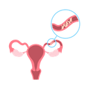 Discharge and itchiness