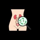 "Diagram of urinary tract infection (UTI) showing inflamed bladder, urethra, and bacterial infection in urinary system"