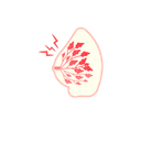 Sore breast