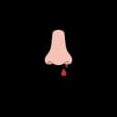 "Pregnant woman experiencing nosebleed due to hormonal changes and increased blood flow during pregnancy"