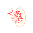 Breast tenderness