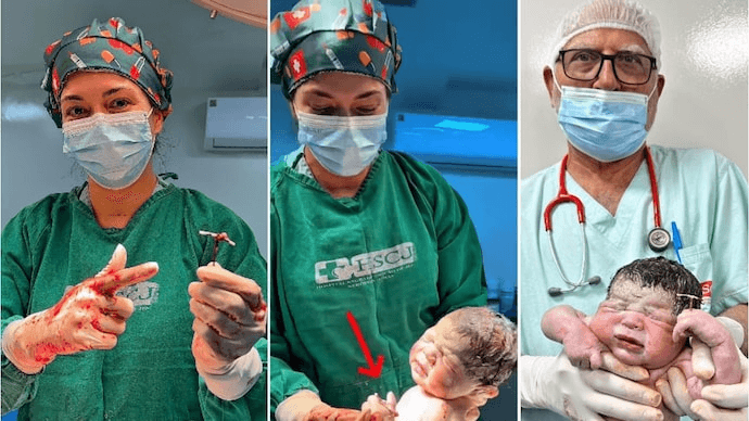 Baby Born Holding Failed Contraceptive Coil After Rare Pregnancy Shock