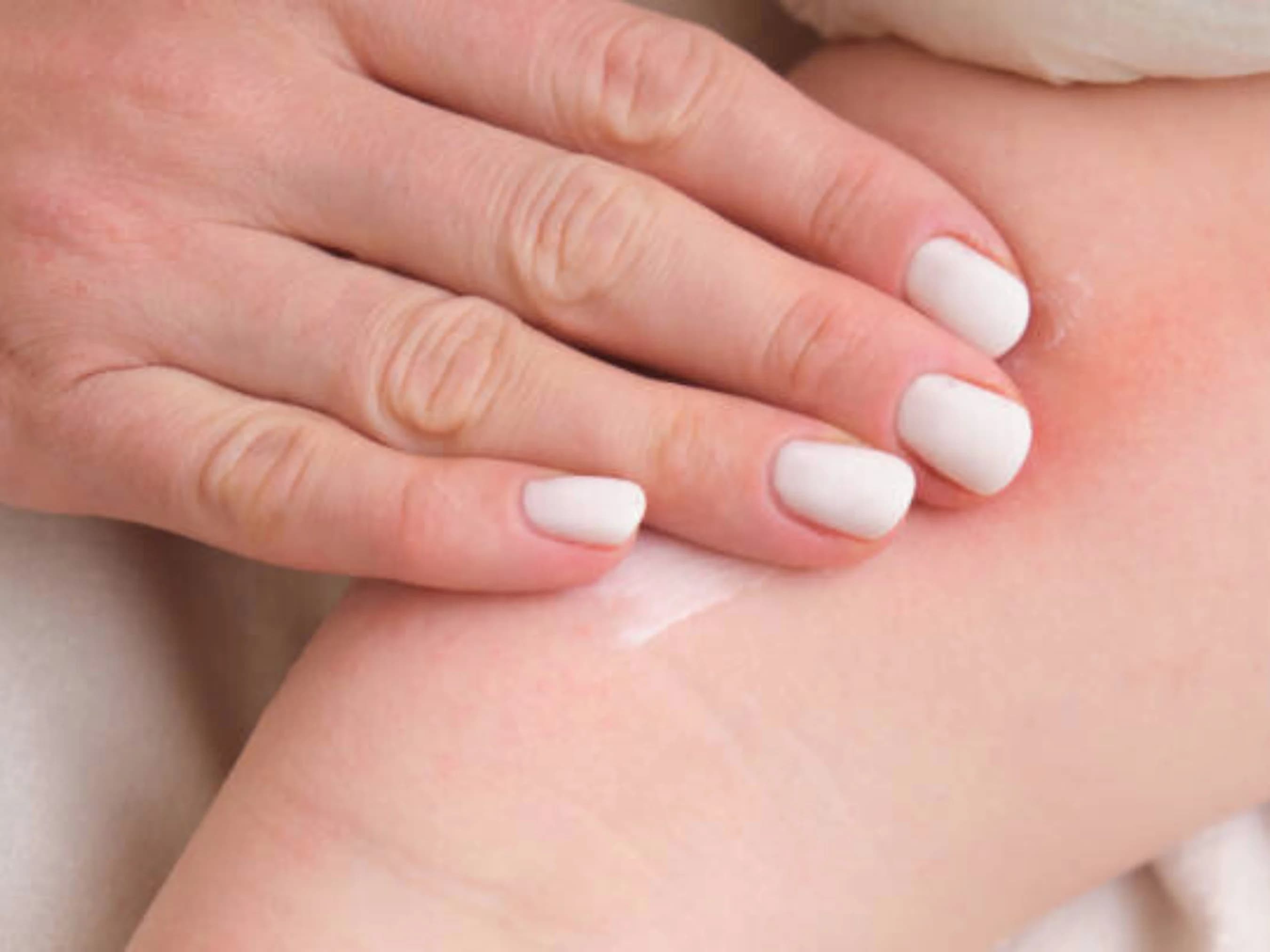 Baby Diaper Rash Prevention and Remedies